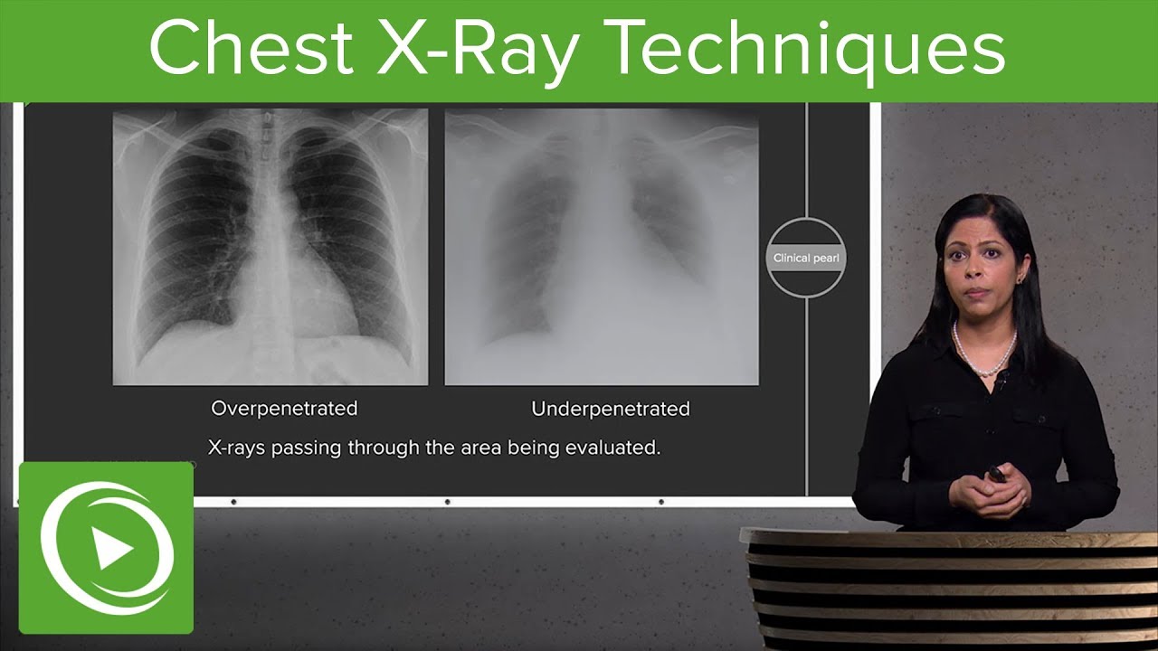 Chest X-Ray Techniques: Inspiration, Penetration, Rotation &ndash; Radiology | Lecturio