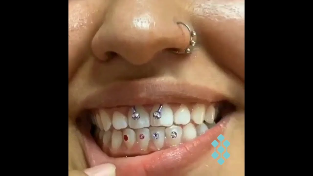 Piercing Dental