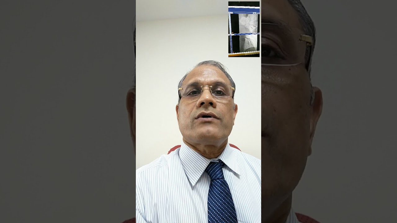 Myocardial bridge in LAD treatment(1)