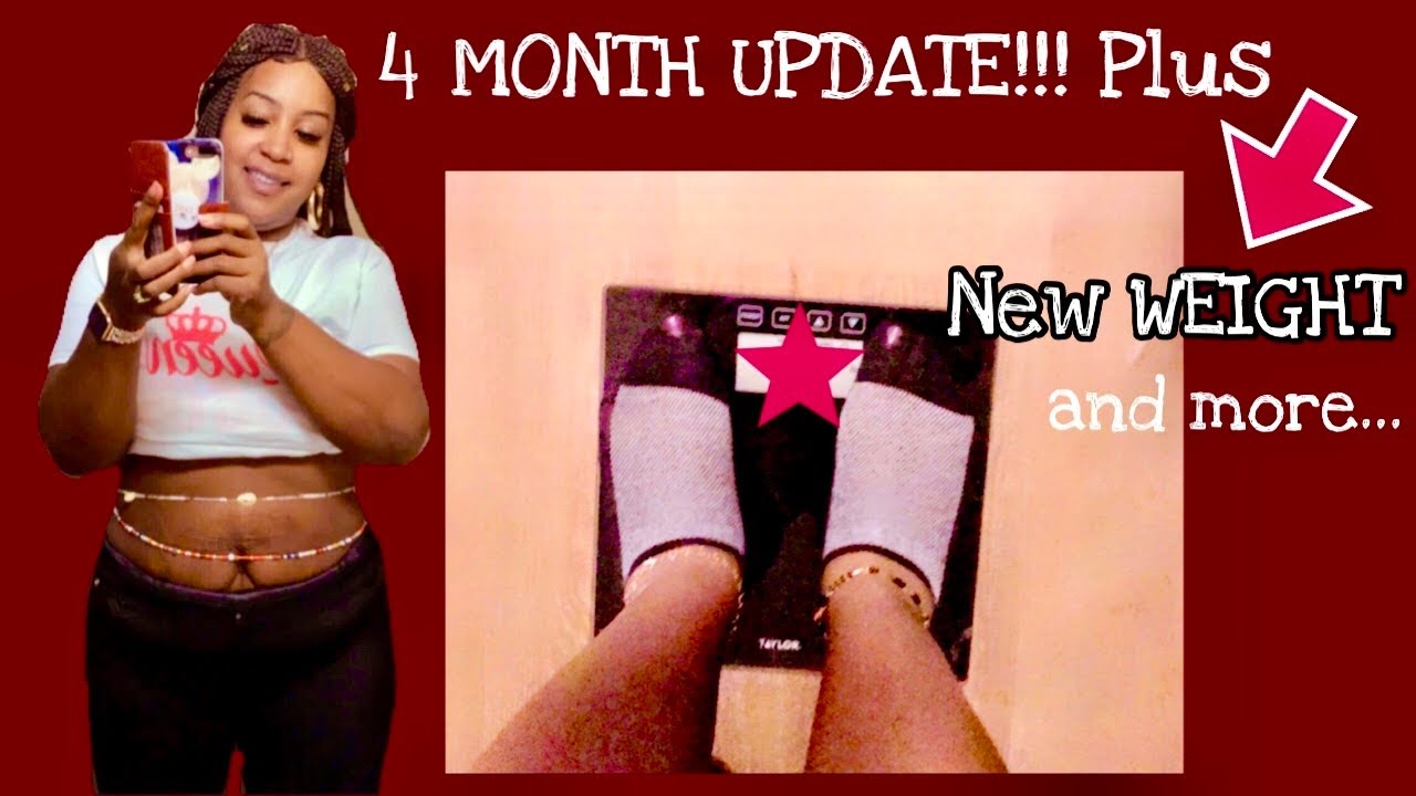VSG Journey: 4 Month SURGIVERSARY Update!!! New Weigh-In+ Hairloss||AngelClassyStyle