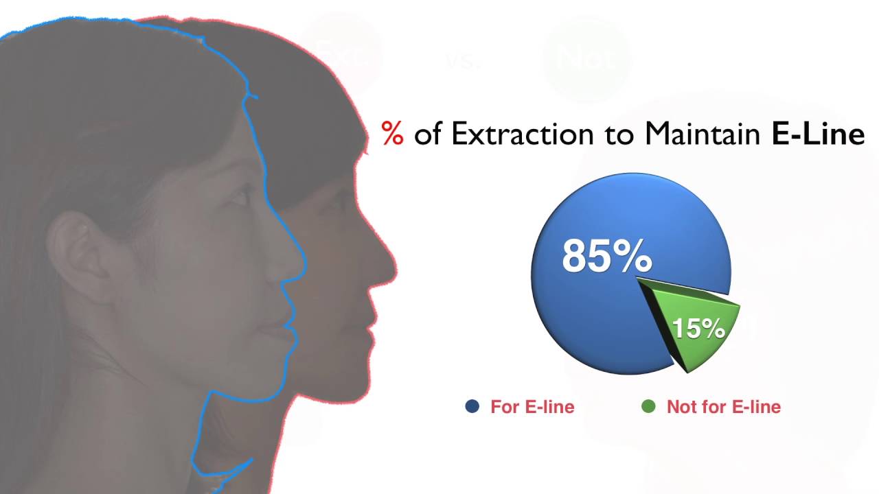 CC393. Ext vs Non-Ext: A Reasonable Plan Statistics and Retrospective Analysis