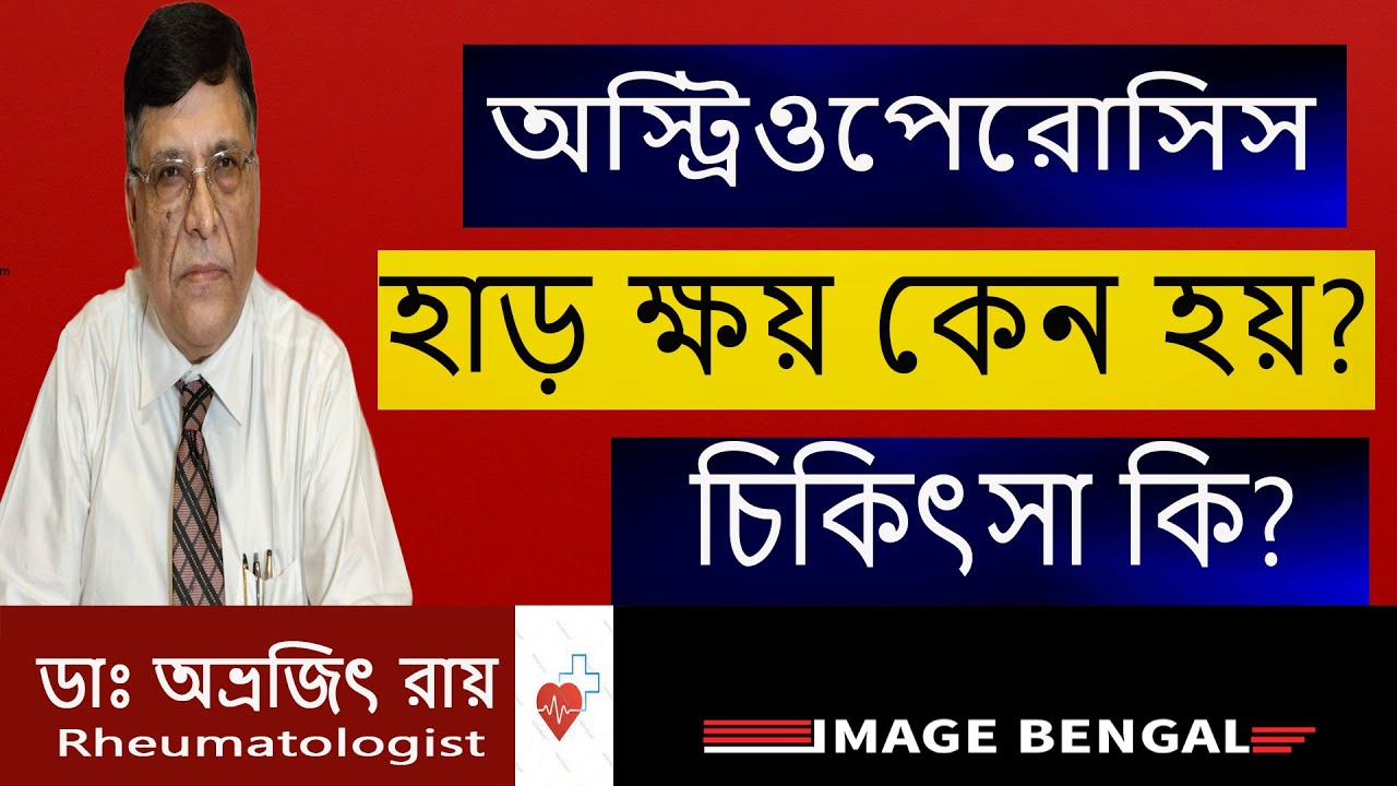 Osteoporosis Treatment, Symptoms || হাড় ক্ষয় কেন হয়, সেরে ওঠার উপায় কী? Dr. Abhrajit Ray