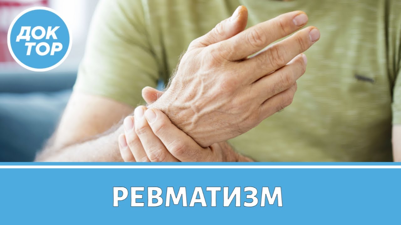Врач–ревматолог рассказал, как обнаружить ревматизм вовремя