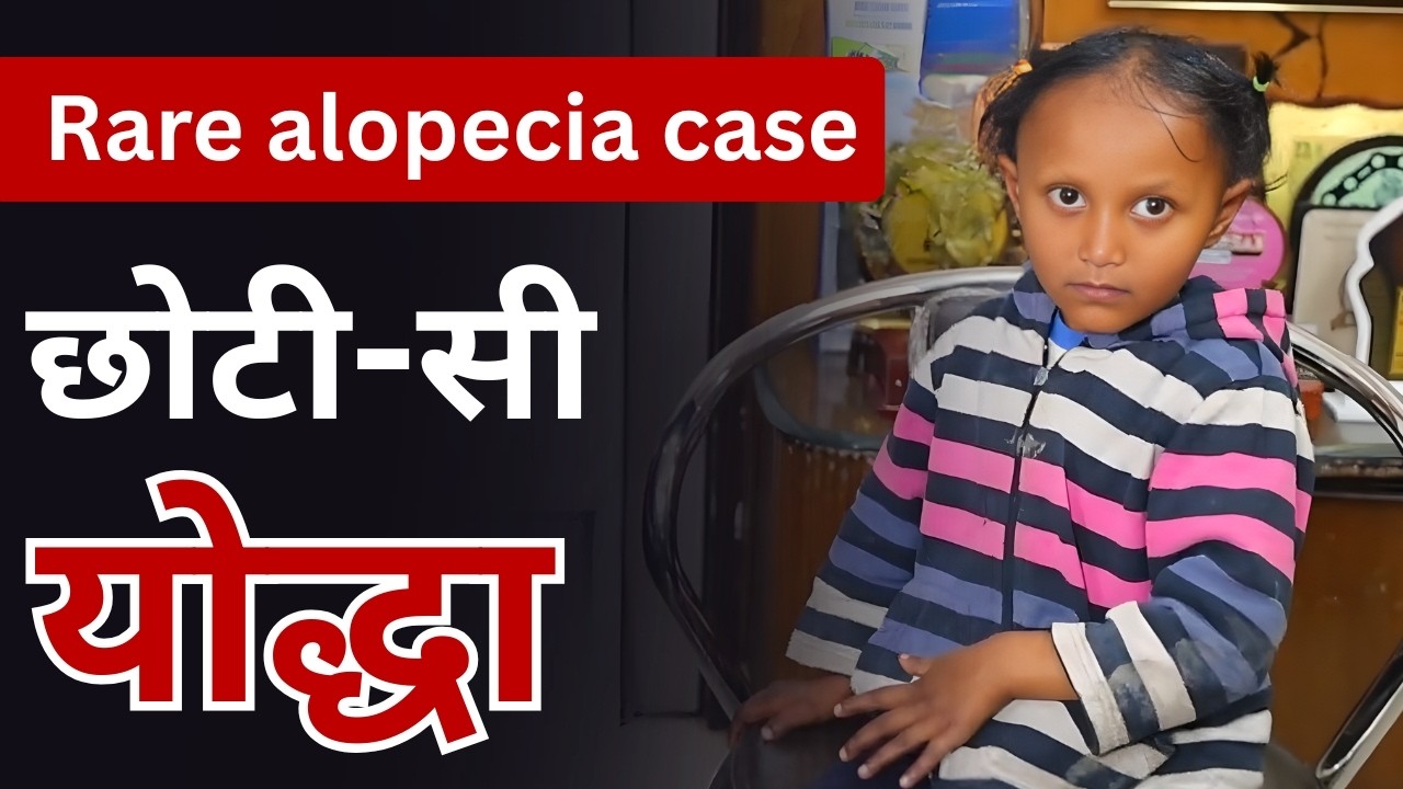 नन्ही उम्र, बड़ा संघर्ष: Alopecia से जूझती एक बेटी की कहानी