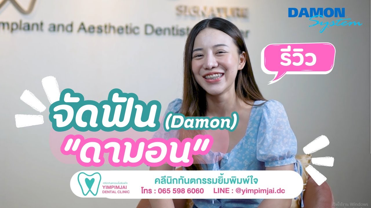 รีวิวจัดฟันแบบดามอน (Damon) และแชร์ประสบการณ์การจัดฟัน | รีวิวร้านทำฟัน ทุ่งครุ