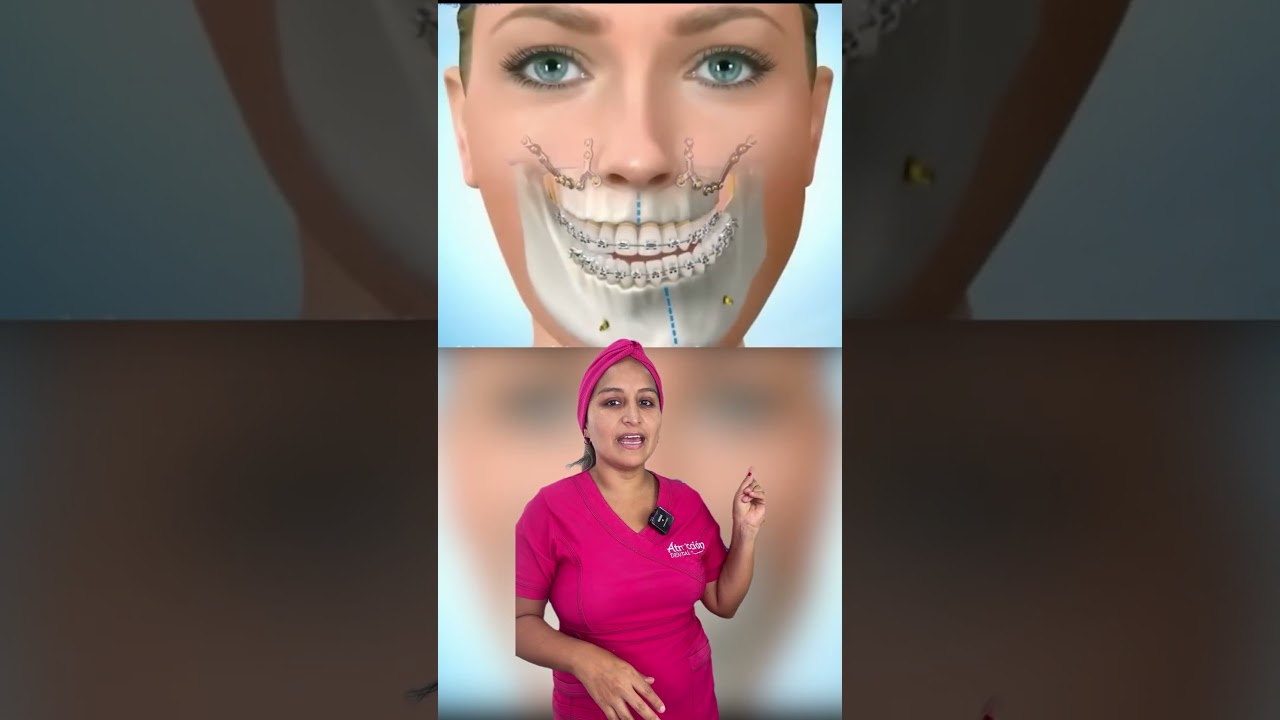 cirug&iacute;a maxilofacial 🤓