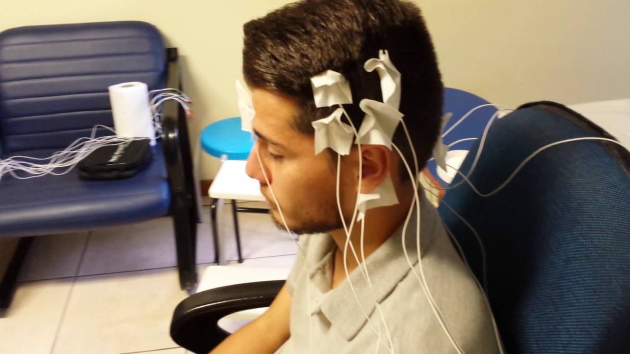 Curso prático de  Eletroencefalograma ocupacional - Telemedicina Morsch