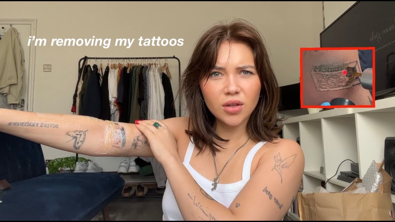 getting laser tattoo removal at 21