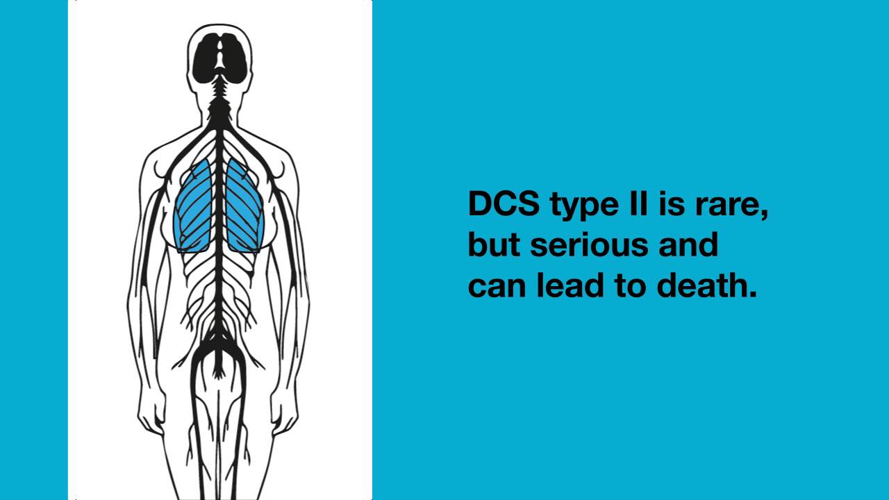 Decompression Sickness