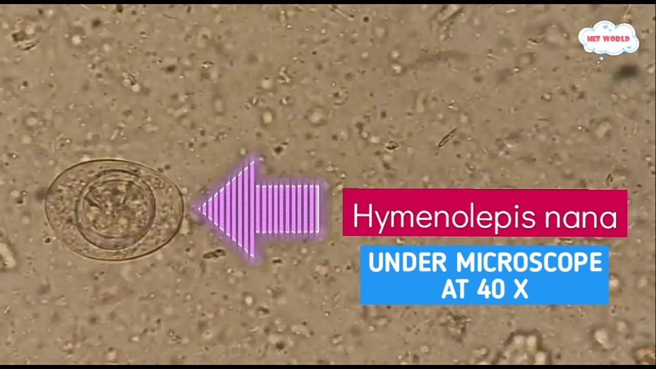 Hymenolepis nana(H.Nana) under microscope.dwarf tapeworm.Best H.nana view under microscope at 40X.