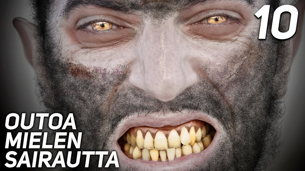 10 HARVINAISTA MIELEN SAIRAUTTA