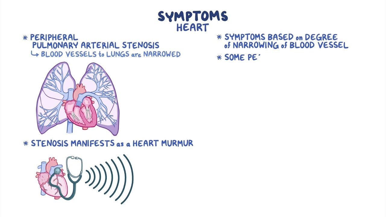 Alagille Syndrome: Causes, Symptoms, and Treatment Options