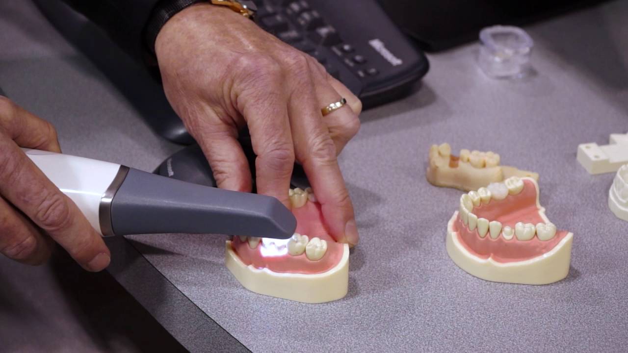 CS 3600 Scanner by Carestream