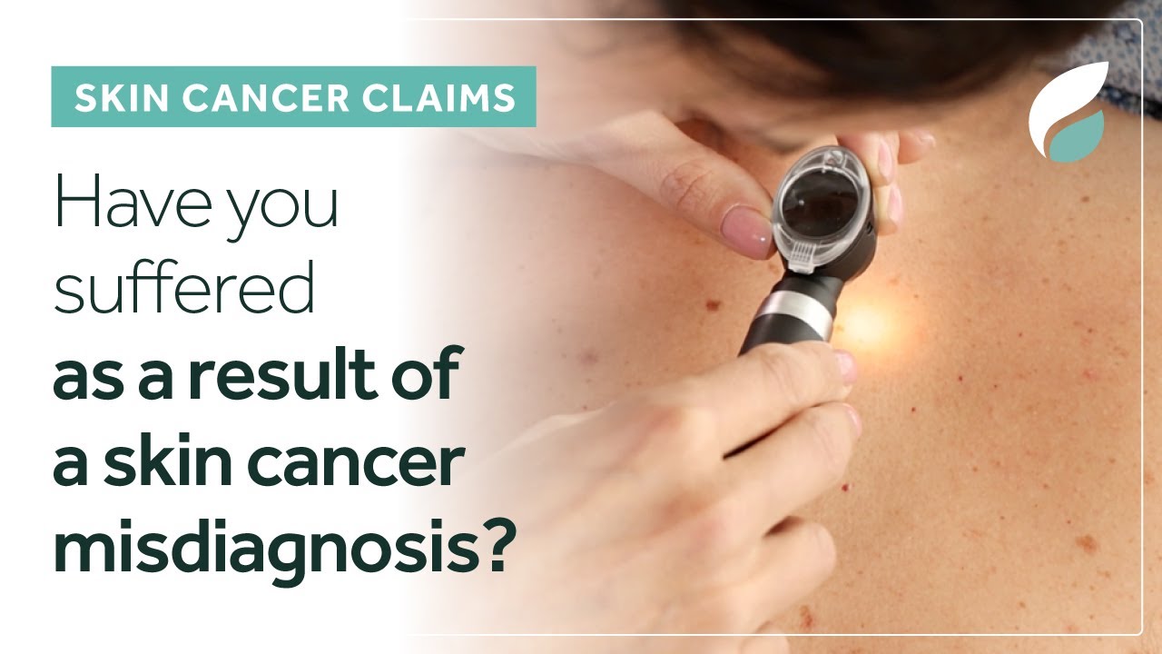 Skin Cancer Claims | Medical Misdiagnosis Due to Negligence