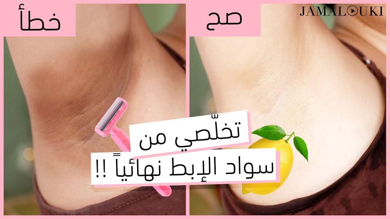 تبييض الابط: وصفات مثبتة علمياً | تفتيح الابط