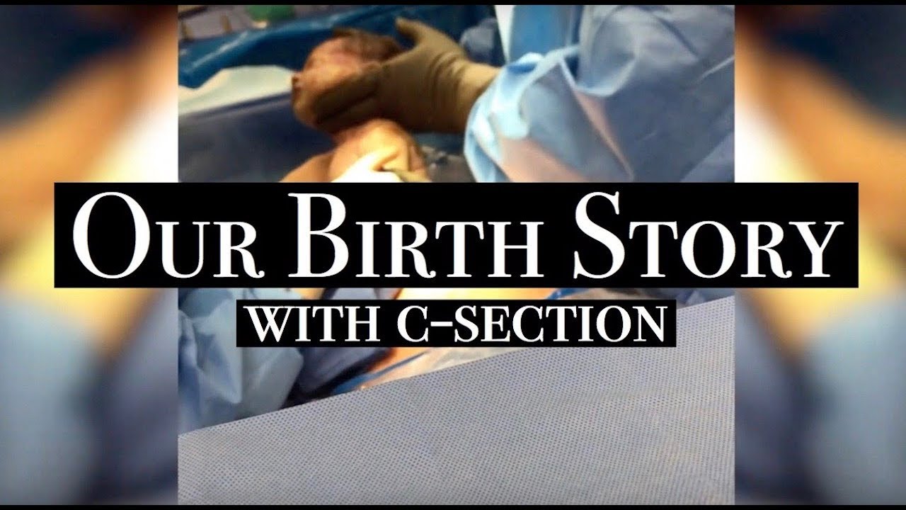 Our Birth Story with c-section.
