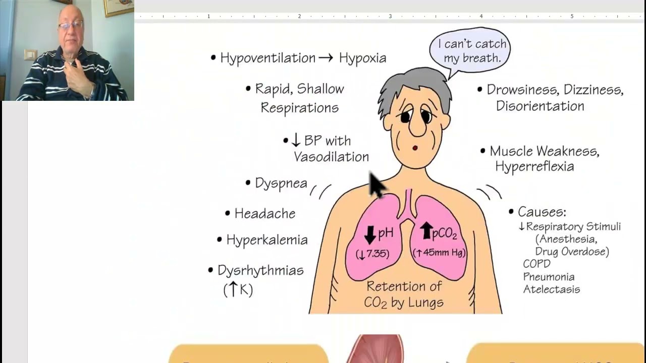 Fluid and electrolyte balance in Arabic  (Respiratory alkalosis), by Dr. Wahdan.