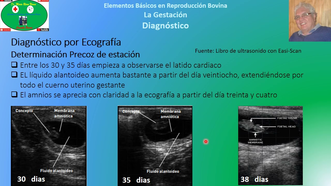 Gestación en Bovinos Parte 4: Ecografía