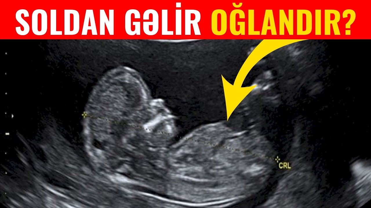 Uşaq Sağdan Gəlirsə Qız Soldan Gəlirsə Oğlandır? - DİQQƏT Həkim Açıqladı!