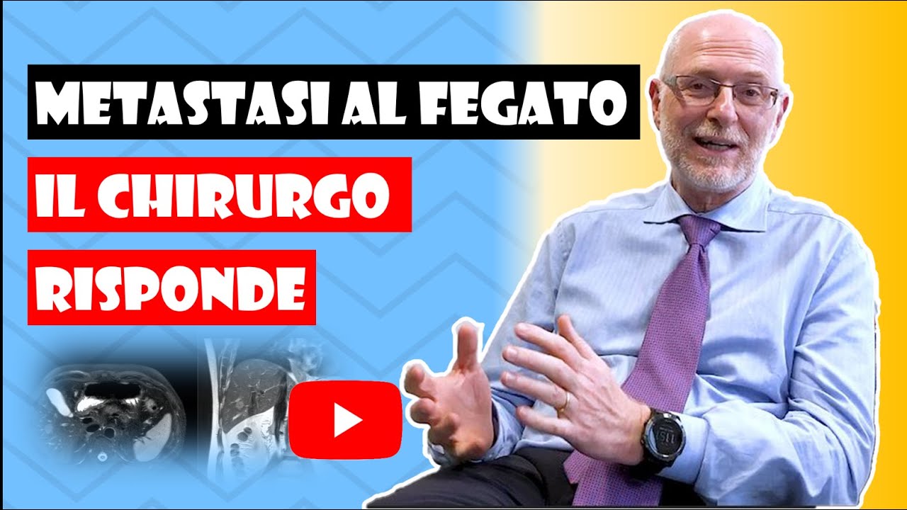 METASTASI AL FEGATO - Intervista al mio chirurgo Prof. Pietro Majno
