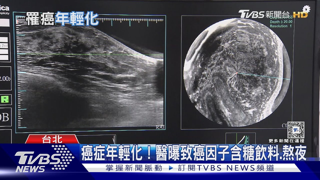 罹癌不再是老年人專利 世界多國「癌症年輕化」!｜十點不一樣20240424@TVBSNEWS01