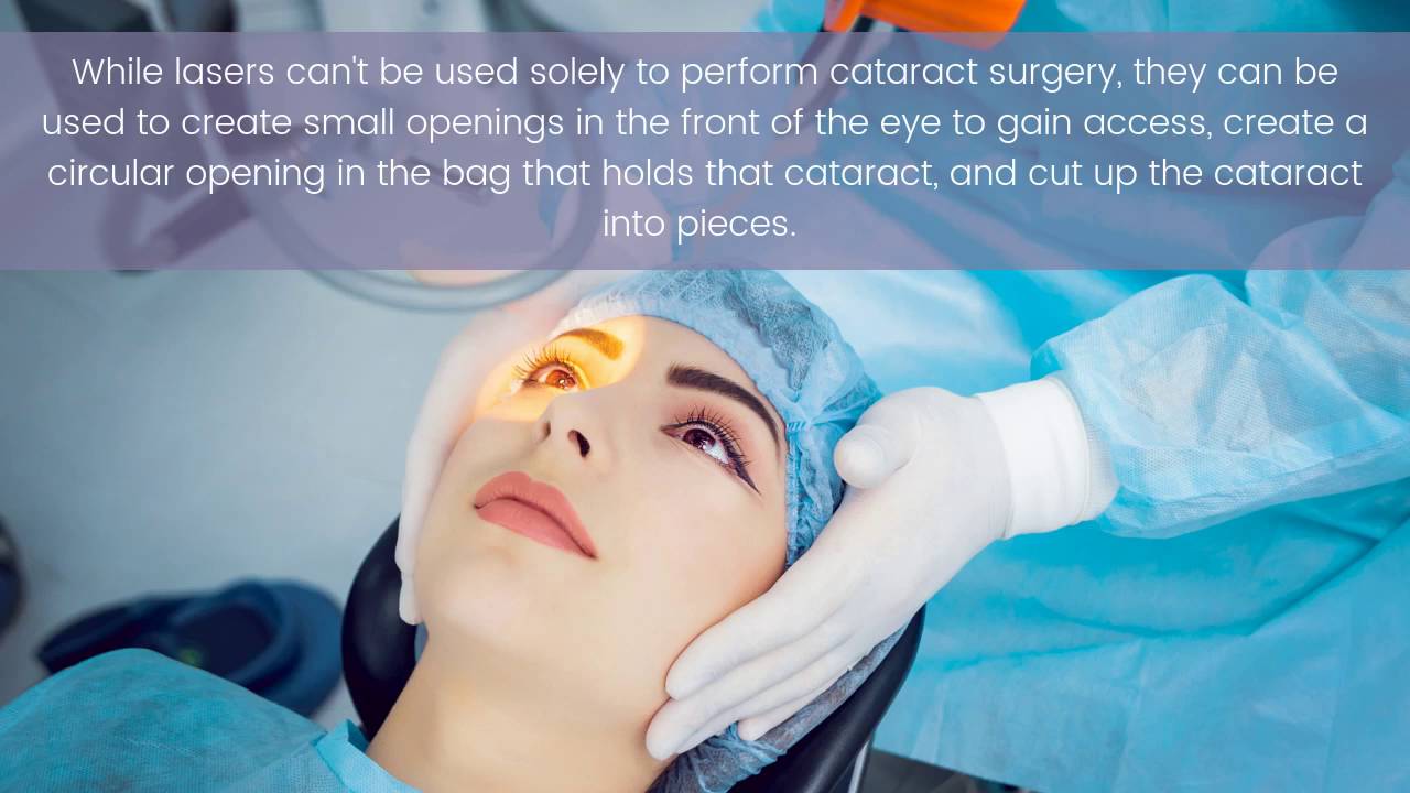 Top ten cataract surgery myths