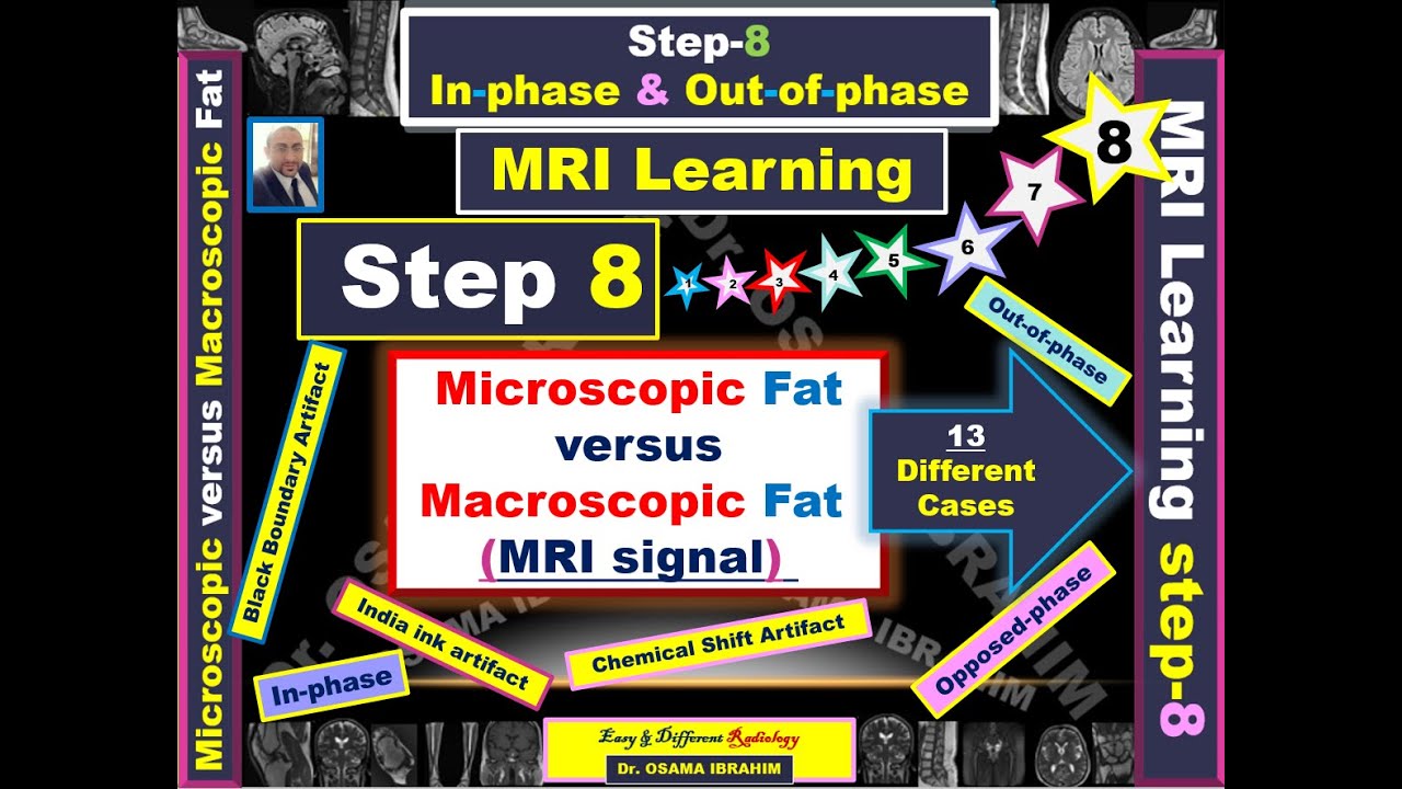 MRI learning 8 -  Macroscopic fat Vs Microscopic fat (Opposed-phase) 13 different cases for practice