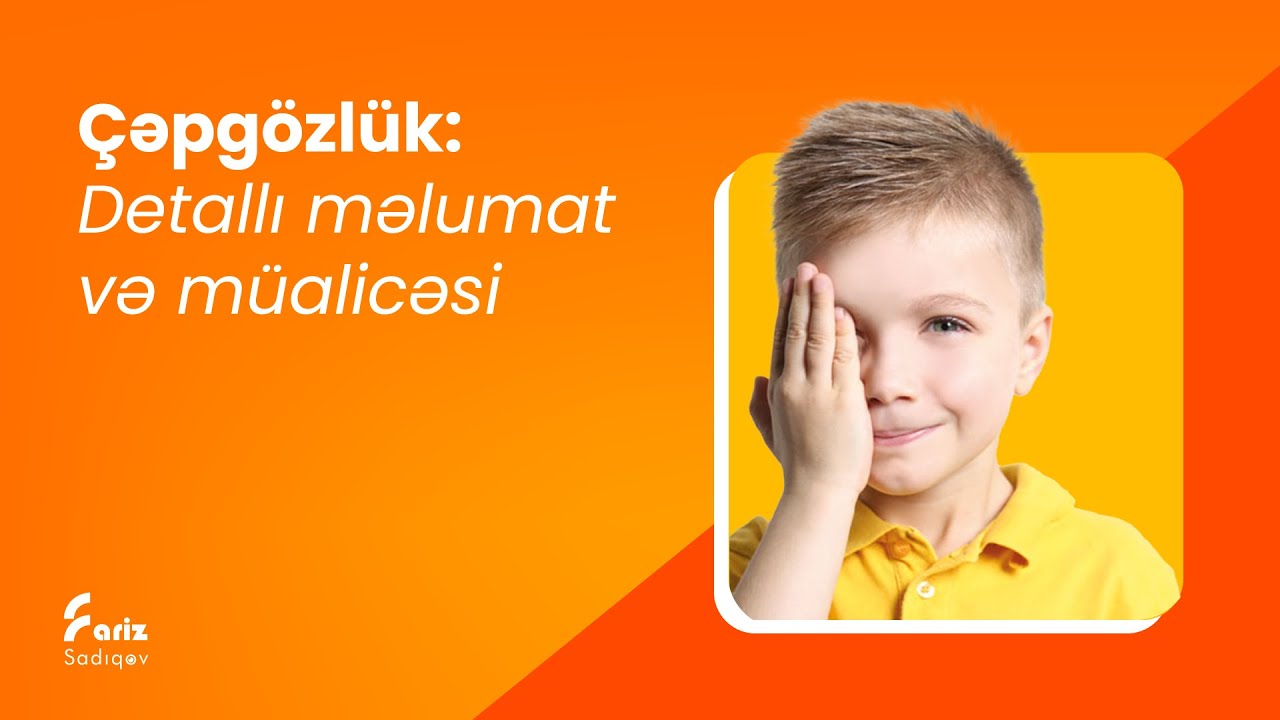Çəpgözlük | Detallı məlumat və müalicəsi | #gözhəkimi #çəpgozluk #gözxəstəlikləri #göz