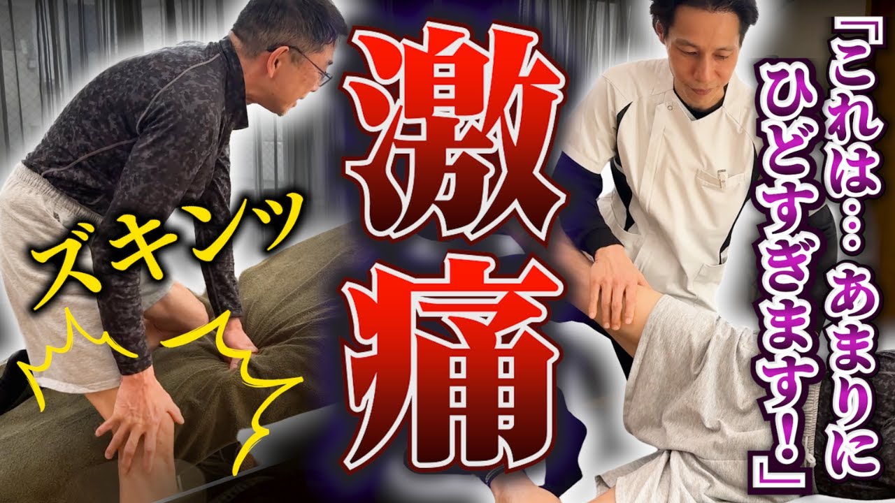 【ズキンッ!!】これはひどすぎる！！座れないし立てない...。重度の坐骨神経痛を癒着剥がし！