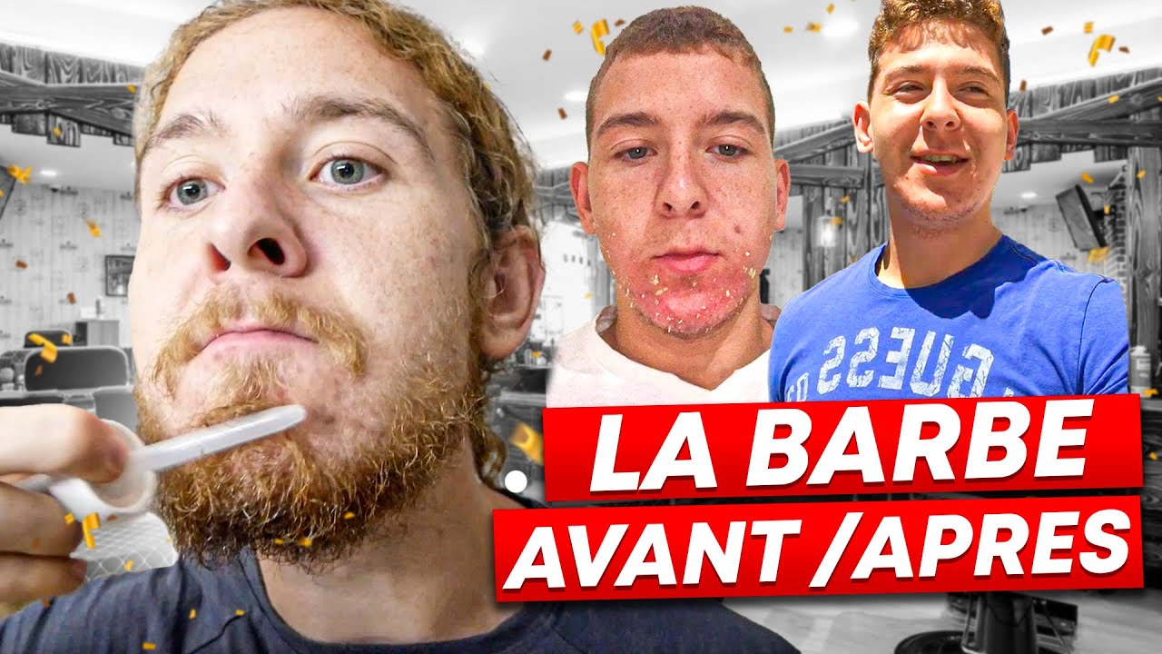FAIRE POUSSER SA BARBE RAPIDEMENT 🧔🏼&zwj;♂️ | Le MINOXIDIL MARCHE VRAIMENT ! ✅