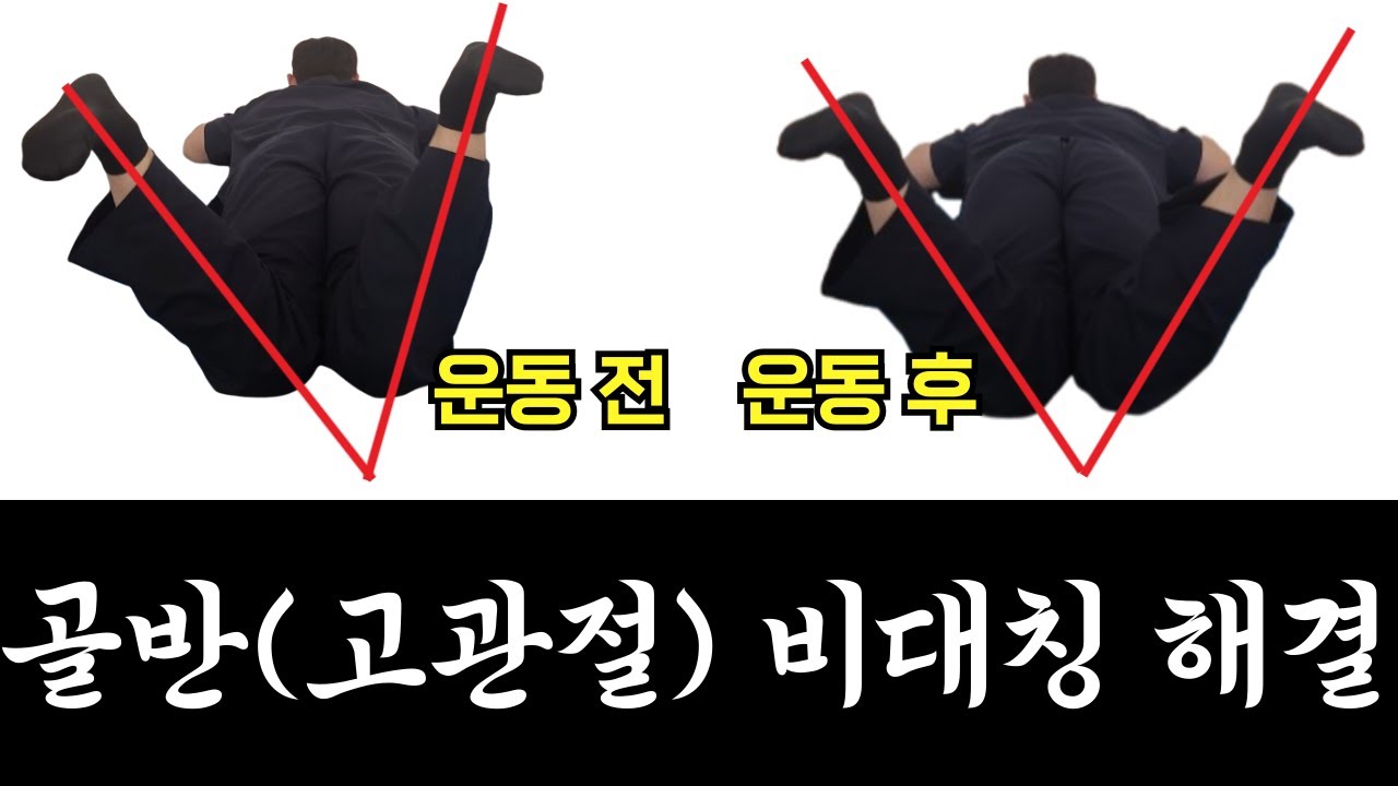 골반 비대칭, 이렇게 좋아집니다((고관절 내회전)