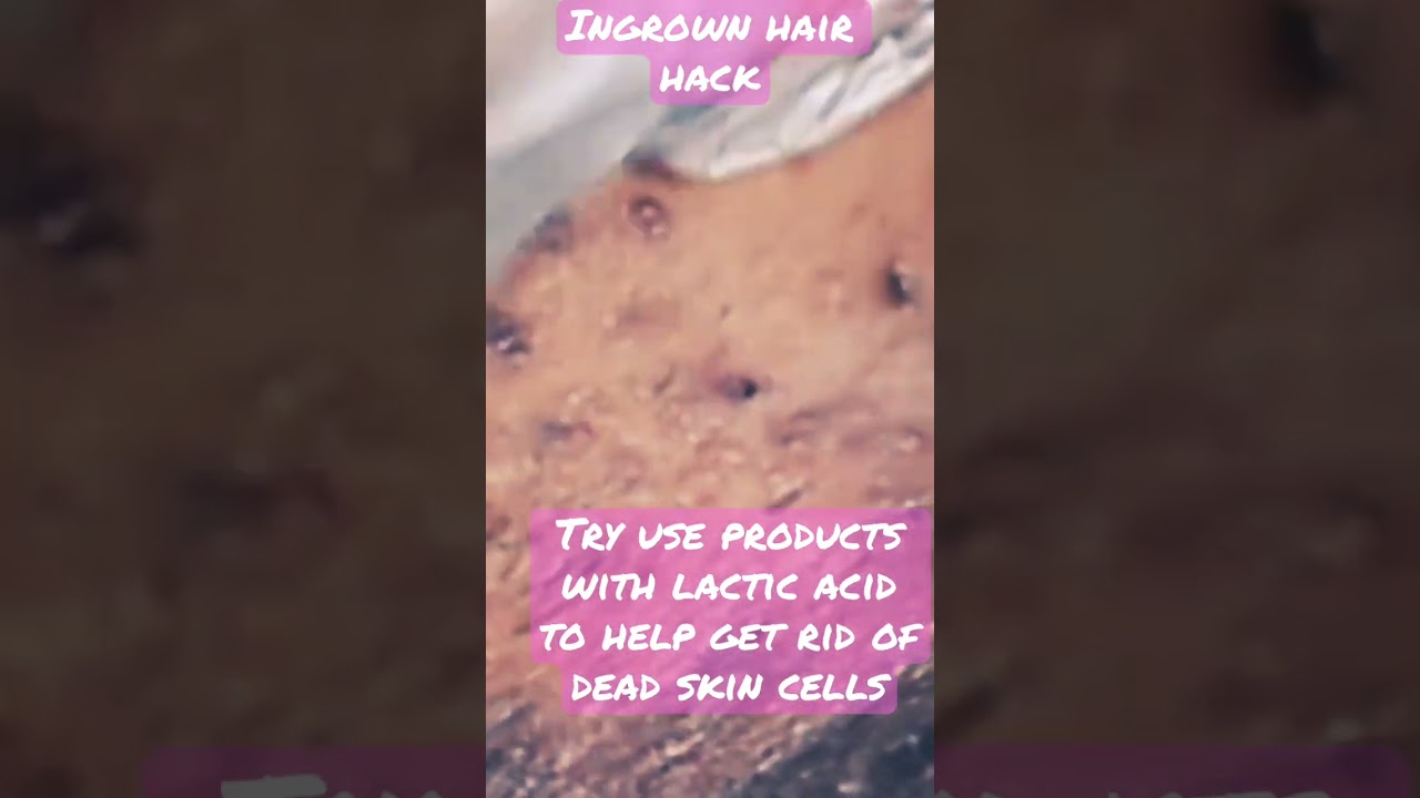 Stop ingrown hairs #hairremoval #skincaretips #shaving #waxing #skincare