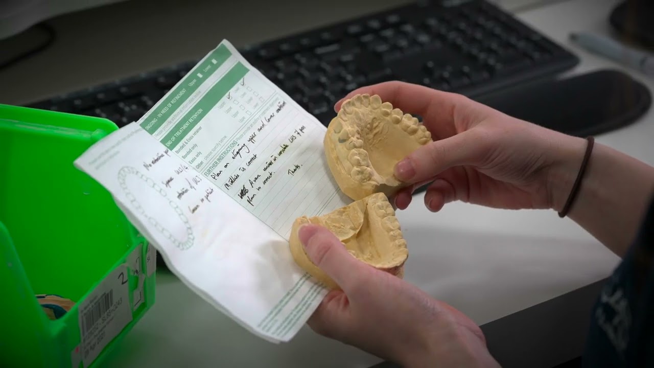 Smilelign Clear Braces - The Lab Journey