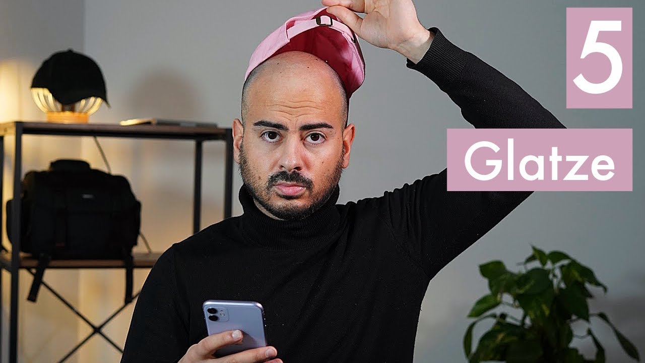 Leben mit Glatze - 5 schockierende Fakten | Erfahrung