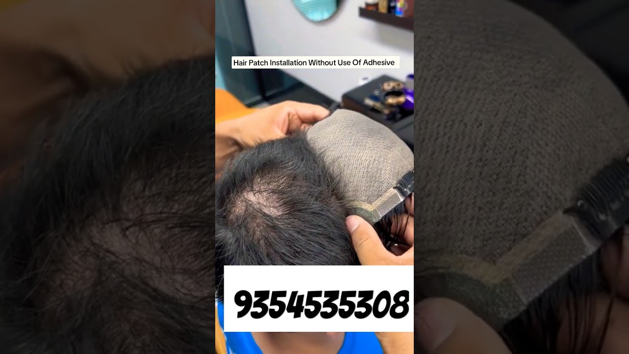hair patch clipping hair #shorts  #trending