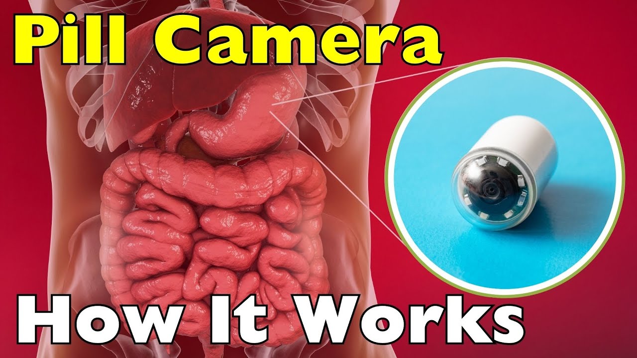 How A Pill Camera Sees Inside Your Body