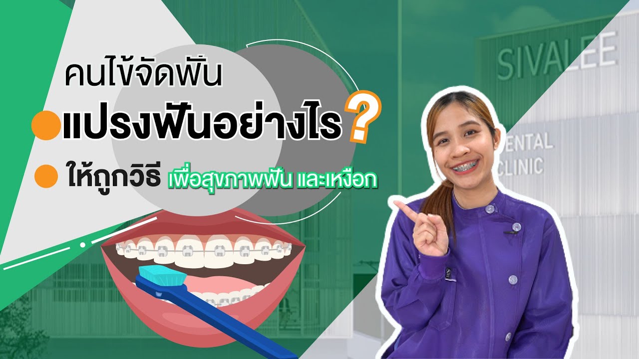 วิธีแปรงฟัน สำหรับคนจัดฟัน