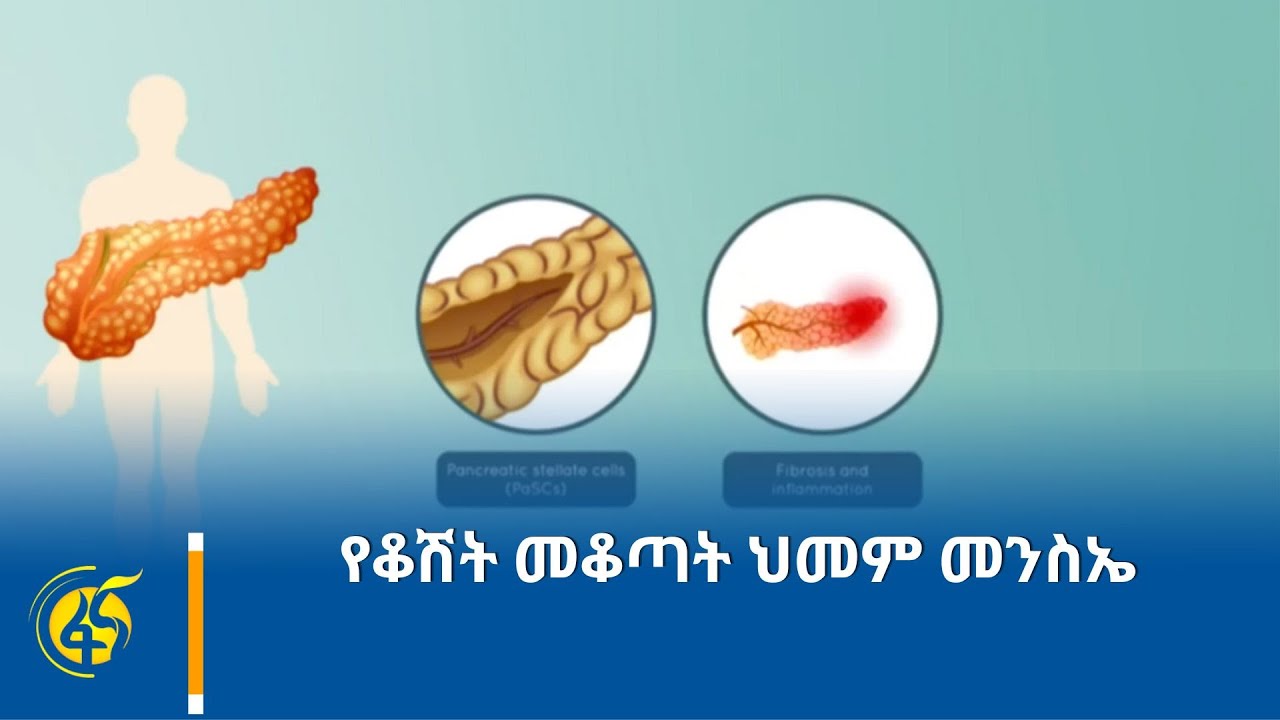 የቆሽት መቆጣት ህመም መንስኤ