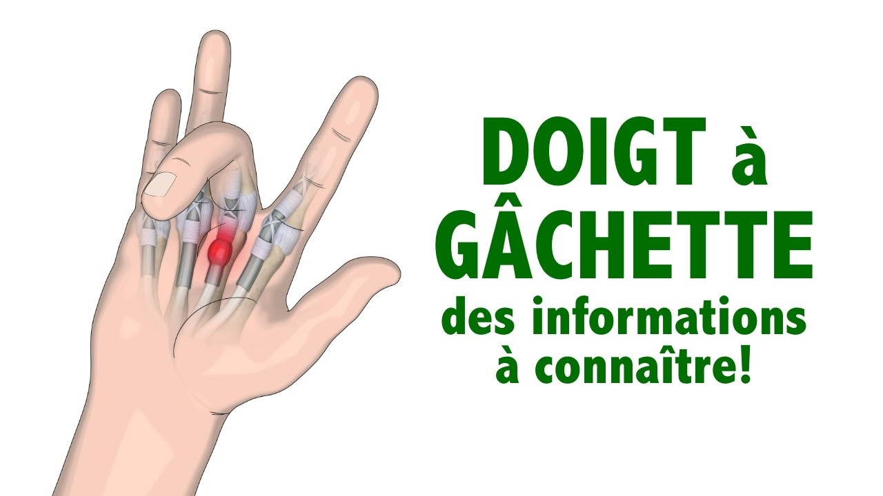 Doigt à gâchette: des informations à connaître! (trigger finger ou ressaut)