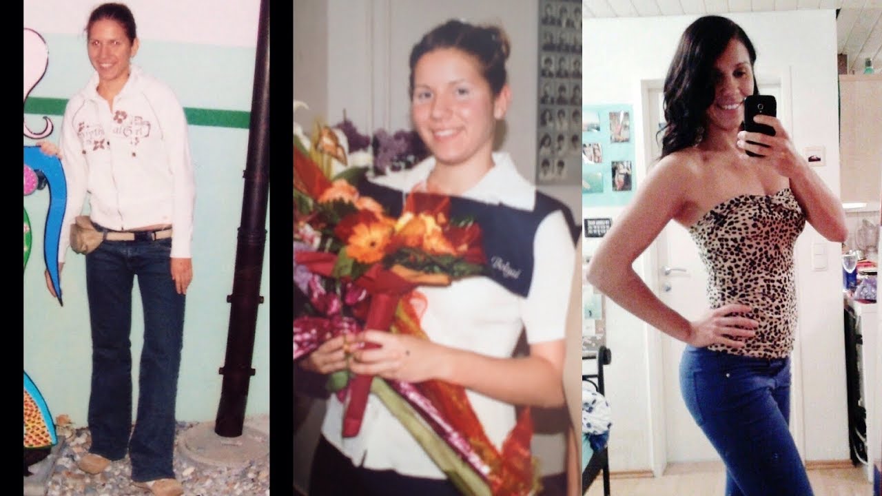 Evészavarról, őszintén (az én történetem)