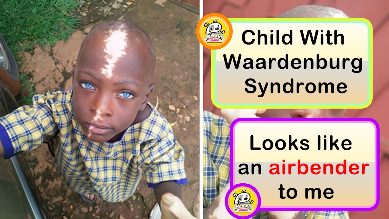 Unique Genetic Traits That Make People Truly One of a Kind