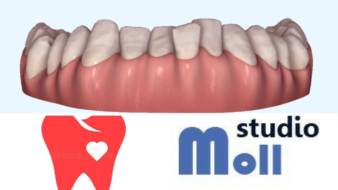 Perché ho dei denti corti?