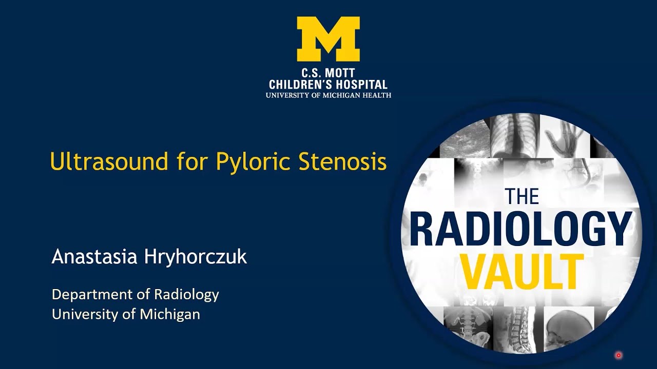 Ultrasound for Pyloric Stenosis