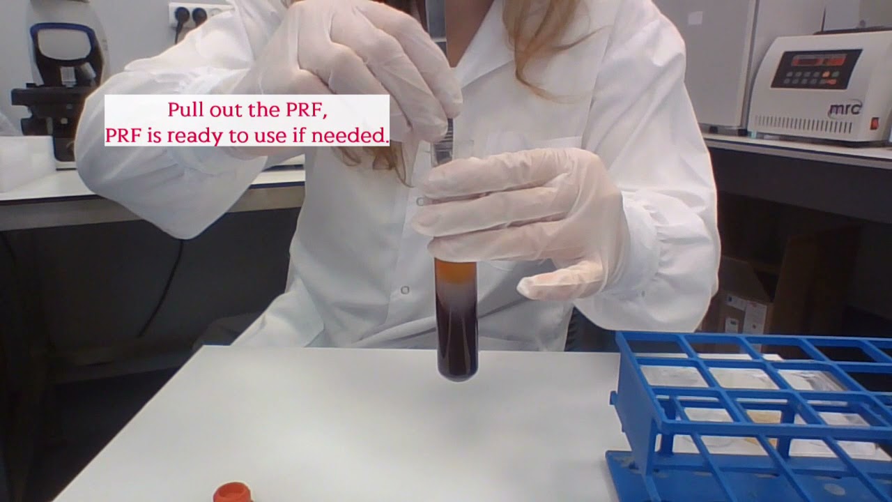 Tropocells&reg; PRFM  demo