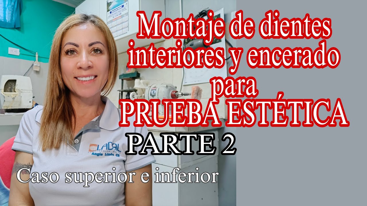 Montaje de dientes inferiores y encerado para PRUEBA ESTETICA PROTESIS FLEXIBLES caso sup/inf
