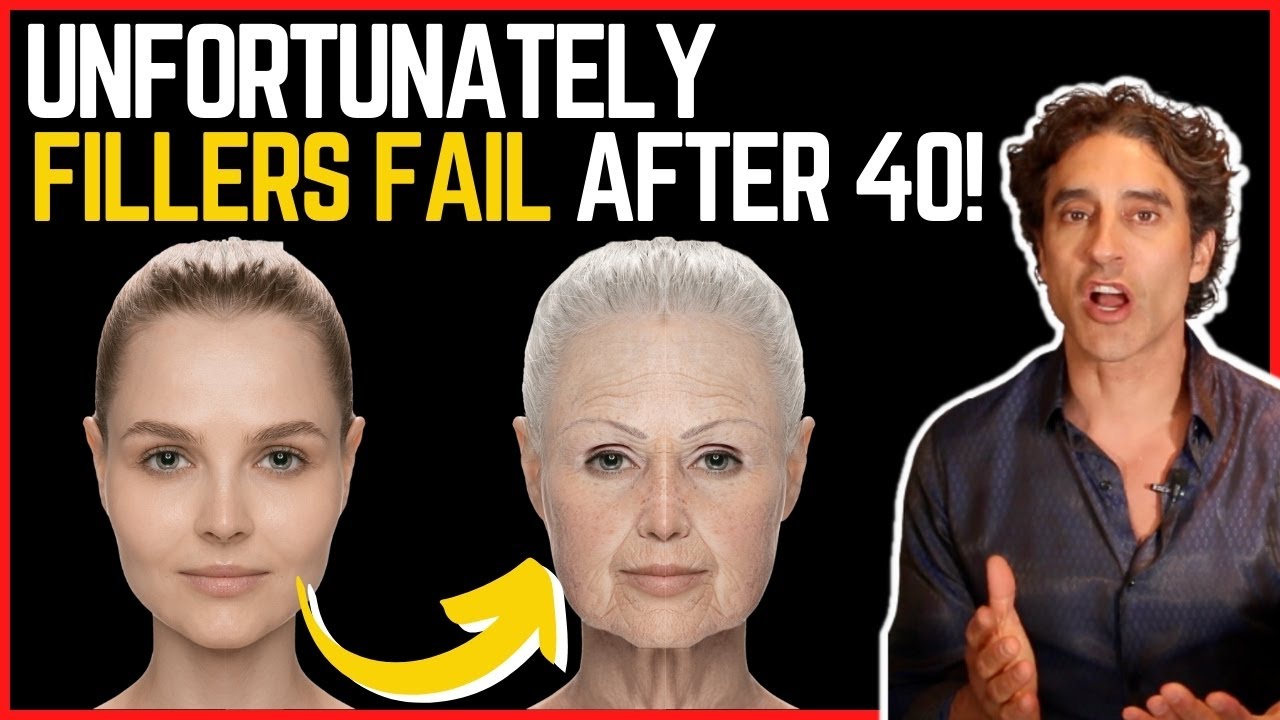 WHY FILLERS STOP WORKING At 40 💉 // How to Look Younger Than Your FRIENDS