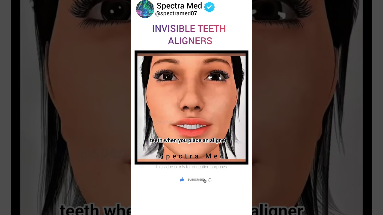 How to Straighten Teeth WITHOUT Braces? Invisible Aligners Magic Revealed