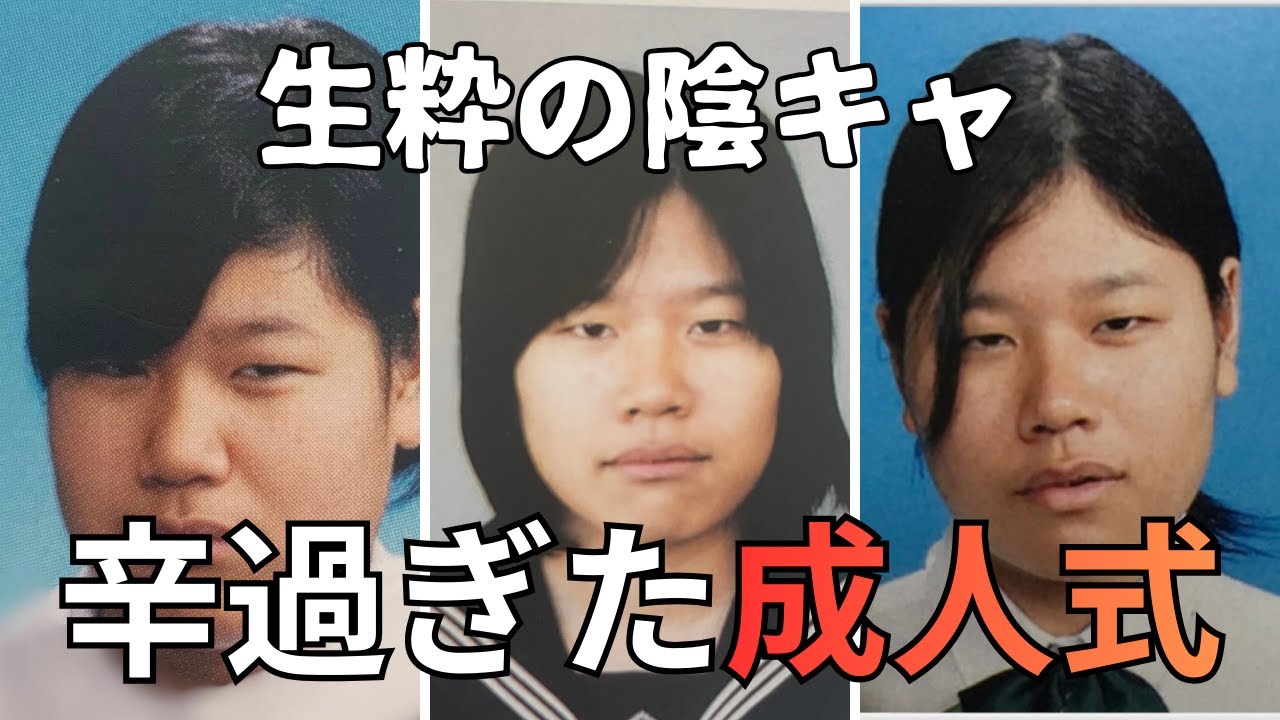 【切ない】ブスで可哀相と笑われてきた私が整形して成人式に挑んだ時の話。