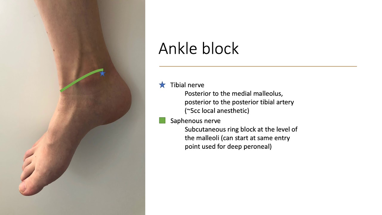 Learnworlds Ankle Block.mp4