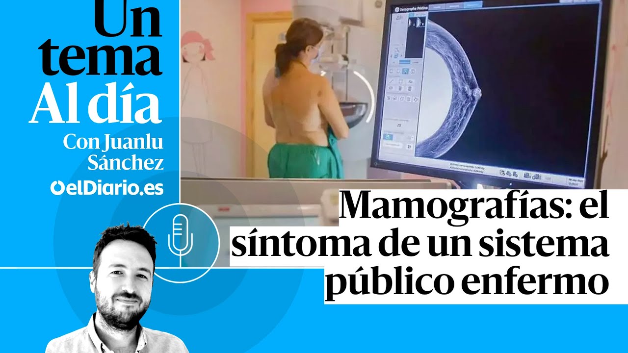 🎙 PODCAST | Mamograf&iacute;as: el s&iacute;ntoma de un sistema p&uacute;blico enfermo &middot; UN TEMA AL D&Iacute;A